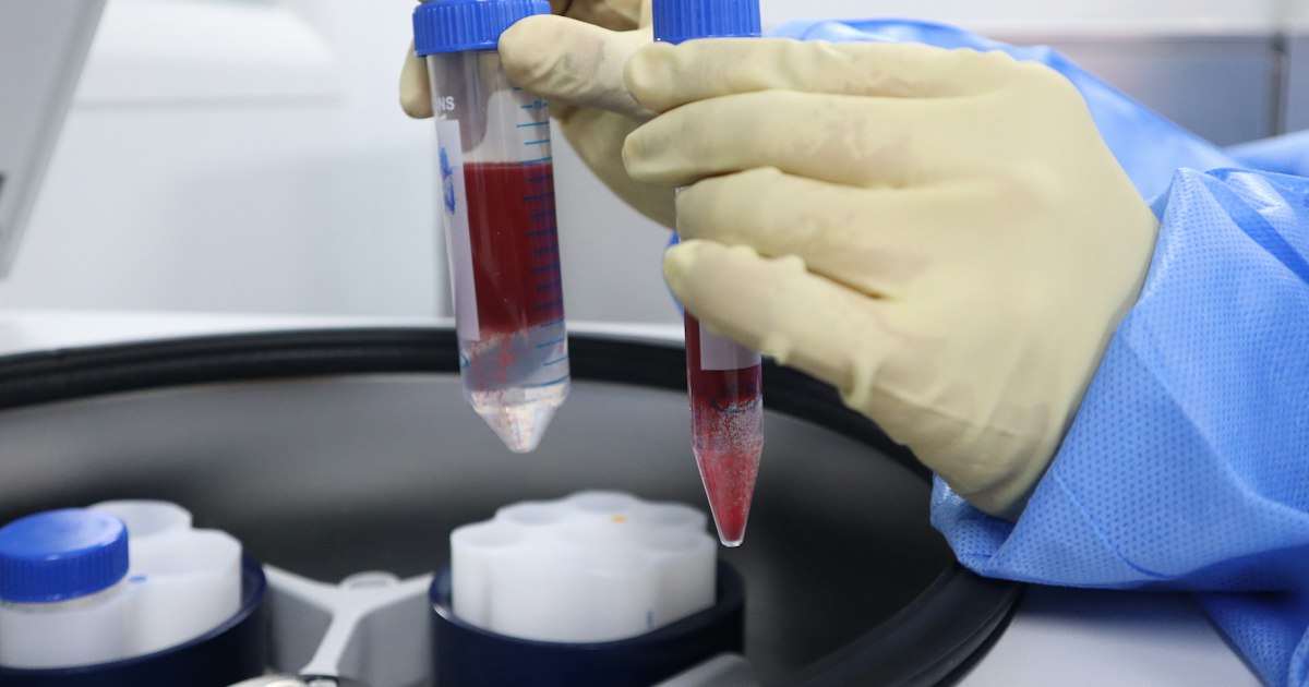 A general urine test above or below normal: causes in athletes and what to do
